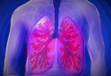 Things you should know about pulmonary disease?
